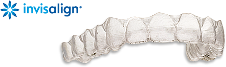 Invisalign Schiene