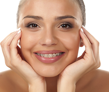 Bild für Keramik Bracket